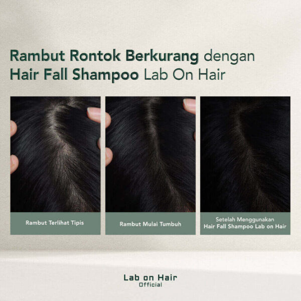 Lab On Hair, Hair Fall Shampoo