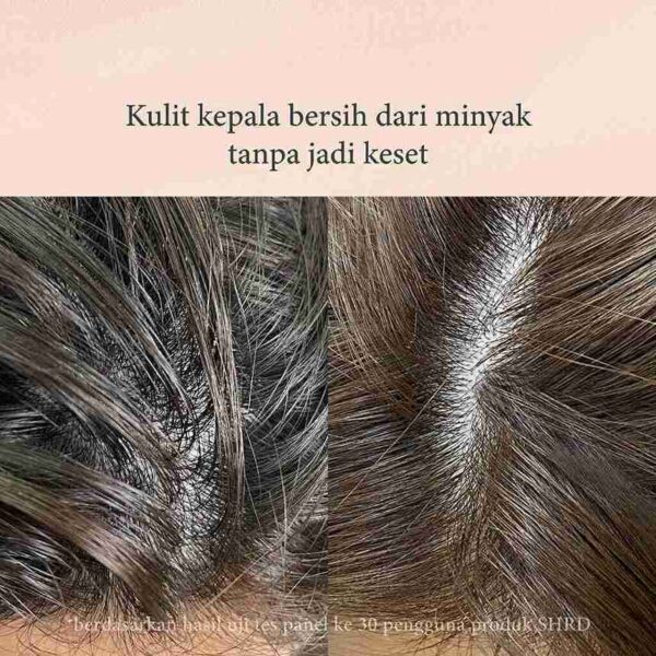 SHRD Shampoo - Before After Bebas Minyak