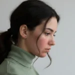 seorang wanita menunduk sedih karena bekas jerawat di wajahnya, PIE, PIH (Image Concept by Homey Button)